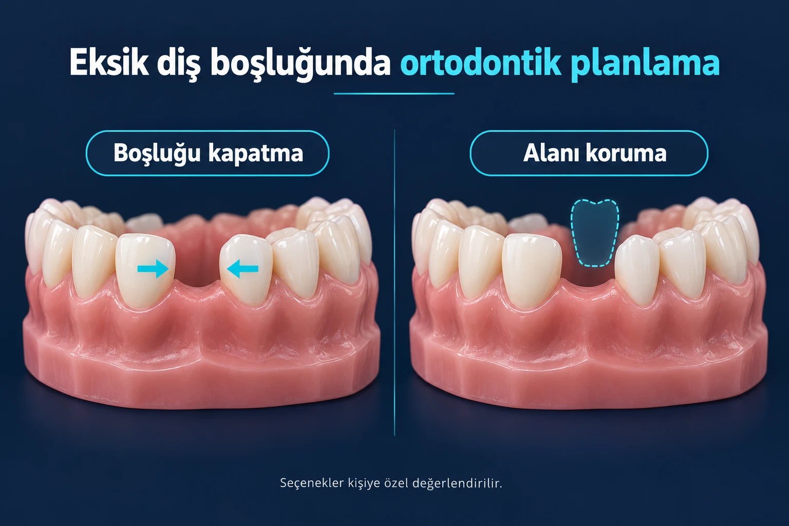 Eksik Diş Boşluğunda Ortodontik Planlama